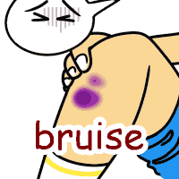 bruise の意味 英語イラスト