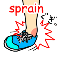 sprain